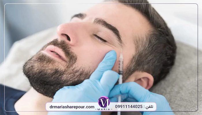 ماندگاری لیفت صورت با فیلر
