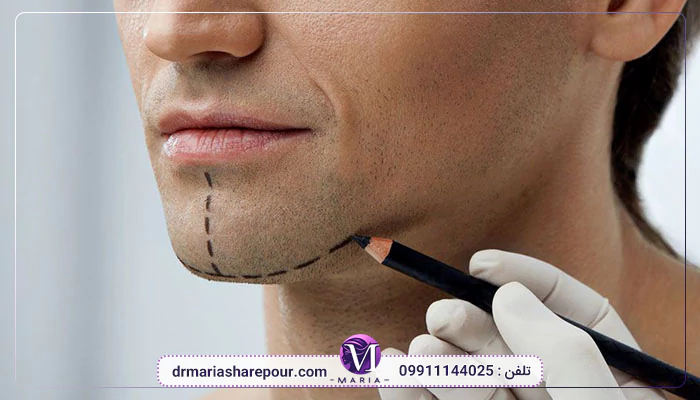 مزایای پروتز چانه در بابل