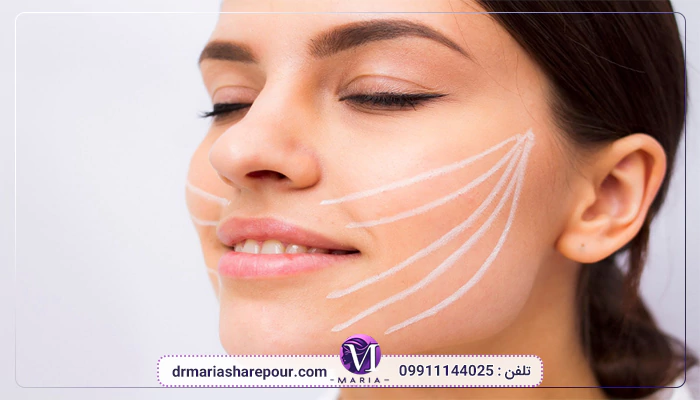 مادلینگ صورت با فیلر چیست؟