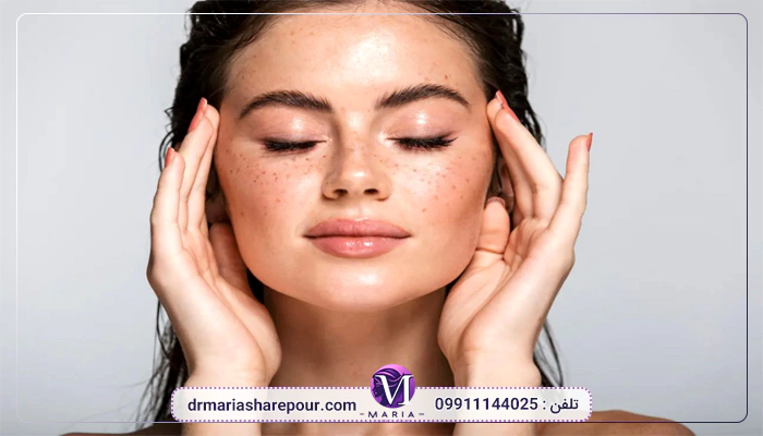 بهترین پزشک لیفت شقیقه
