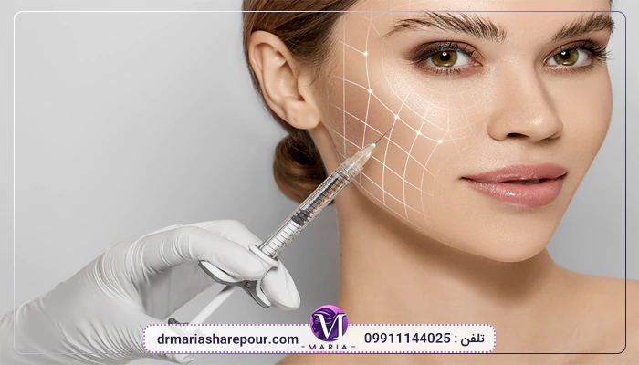 لیفت گونه چیست؟