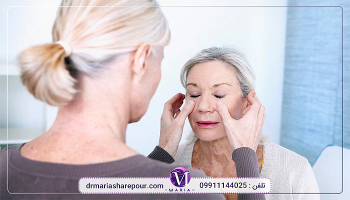 مزایای لیفت گونه در تهران