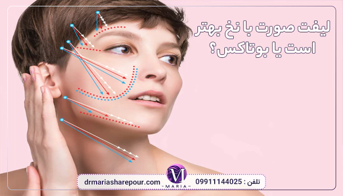 لیفت صورت با نخ بهتر است یا بوتاکس